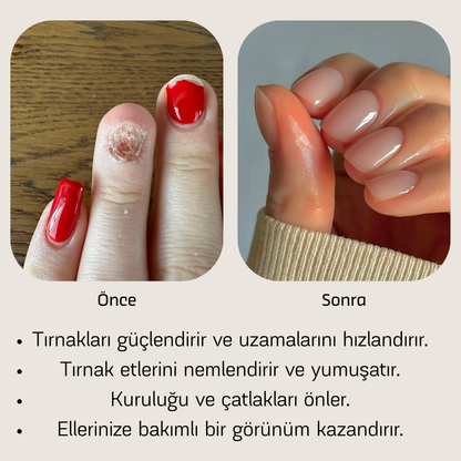 Nailora™ – Doğal Tırnak Bakım Yağı